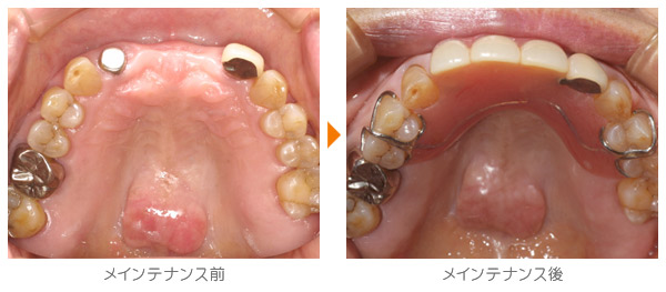 Ｉ・Ｏ様のメインテナンス症例