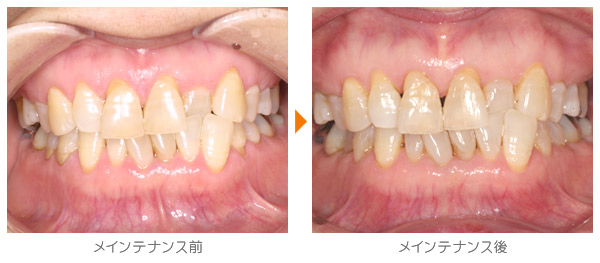 Ｙ・Ｎ様のメインテナンス症例